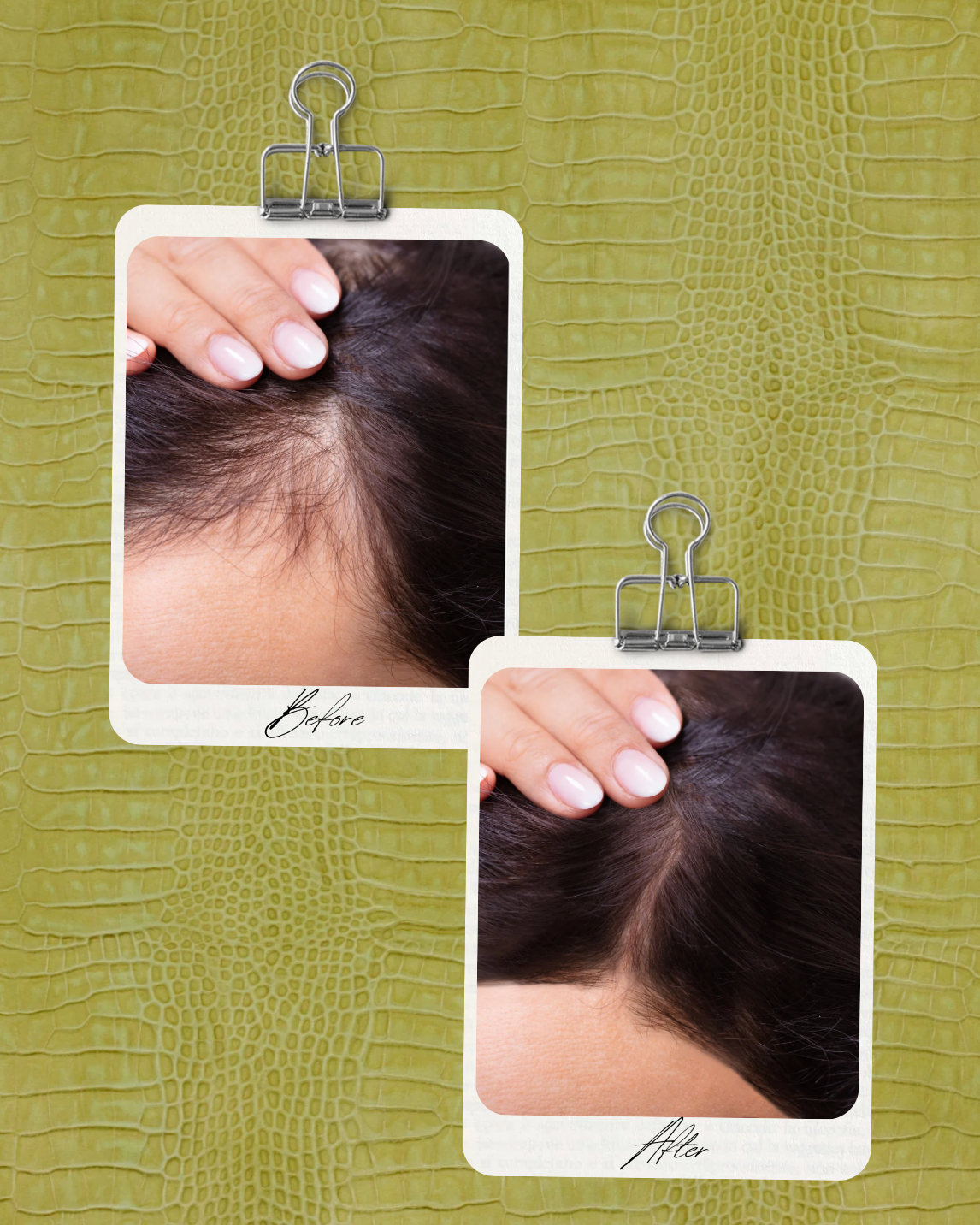 Korean Hair Growth Serum
